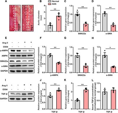 O304 alleviates abdominal aortic aneurysm formation via AMPK/mTOR/MMP pathway activation